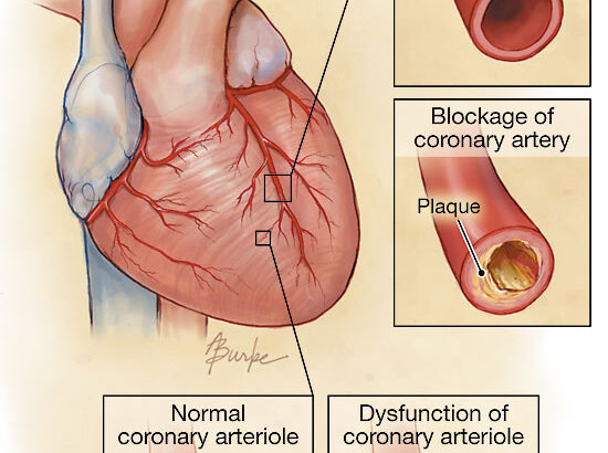 normal-vs-dysfunction-of-coronary-artery